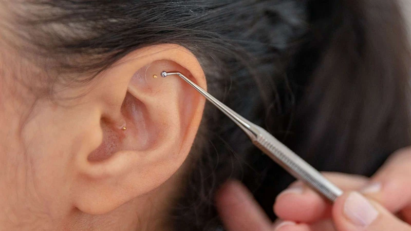 Auricular Therapy
